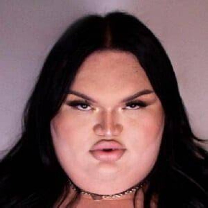 Ali C Lopez Before Surgery Before And After Photos