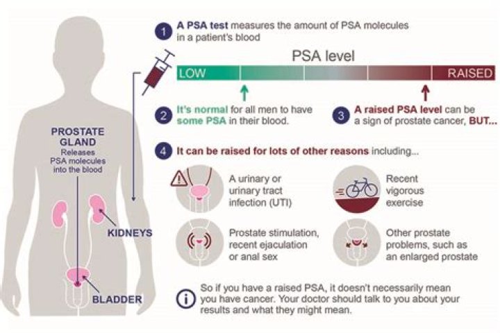 Guidance updated on PSA testing for prostate cancer PHE Screening