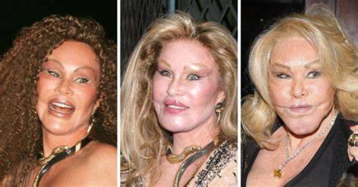 Jocelyn Wildenstein Before And After Plastic Surgery Young Photos- Where Is She Now? ·