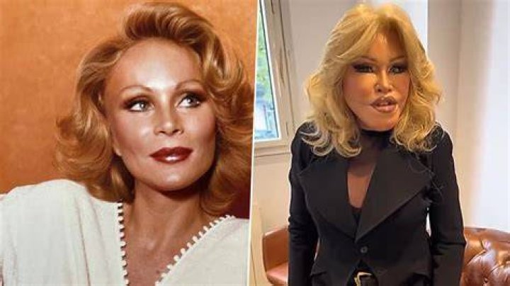 Jocelyn Wildenstein Socialite and Heiress Famous for Plastic Surgery