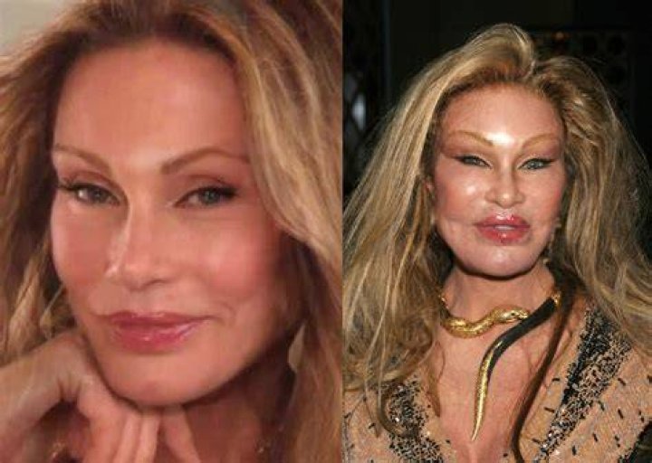 See Jocelyn Wildenstein's Shocking Plastic Surgery Transformation Right